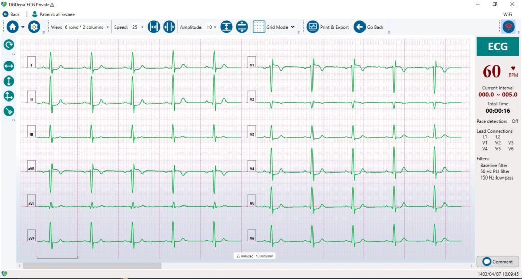 ECG Test